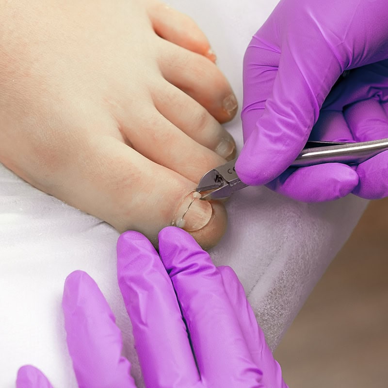 orthonyxie podologin straessle rueti