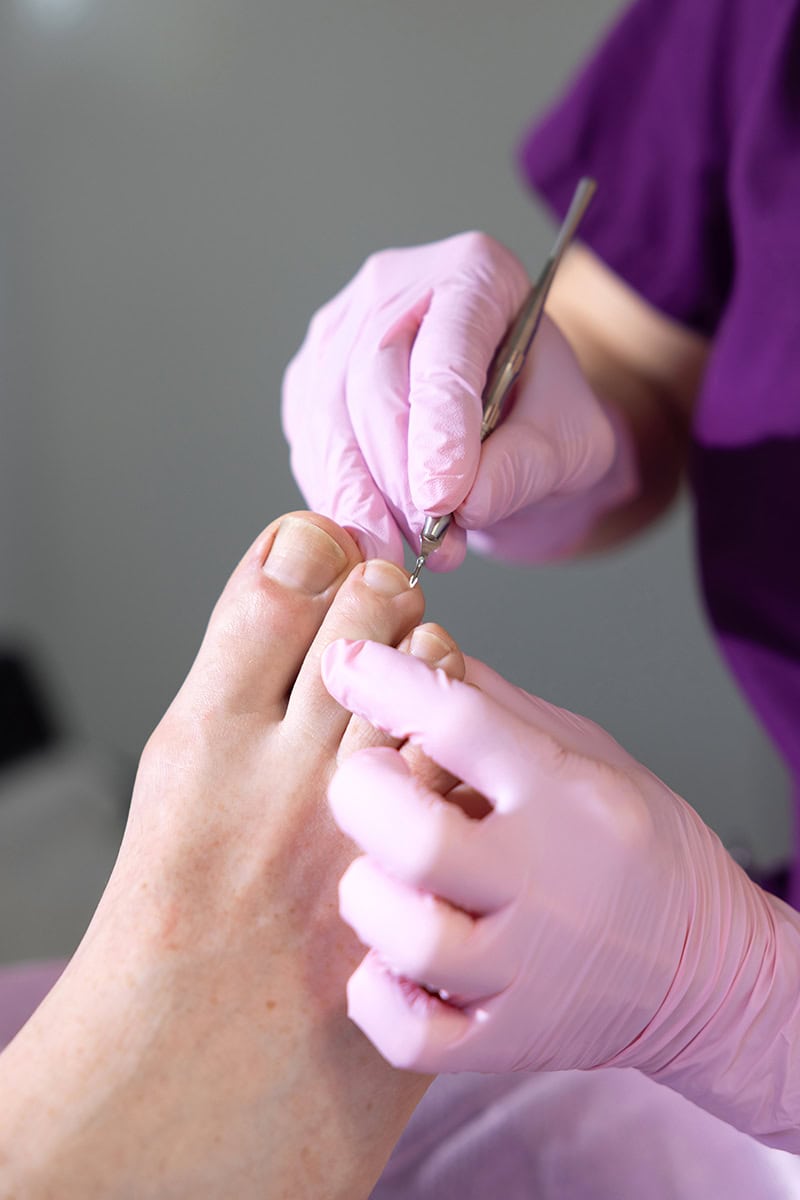 podologie judith straessle nagelbehandlung