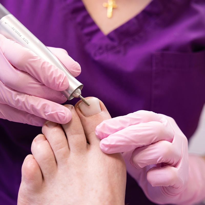 podologie judith straessle nagelprothesen2