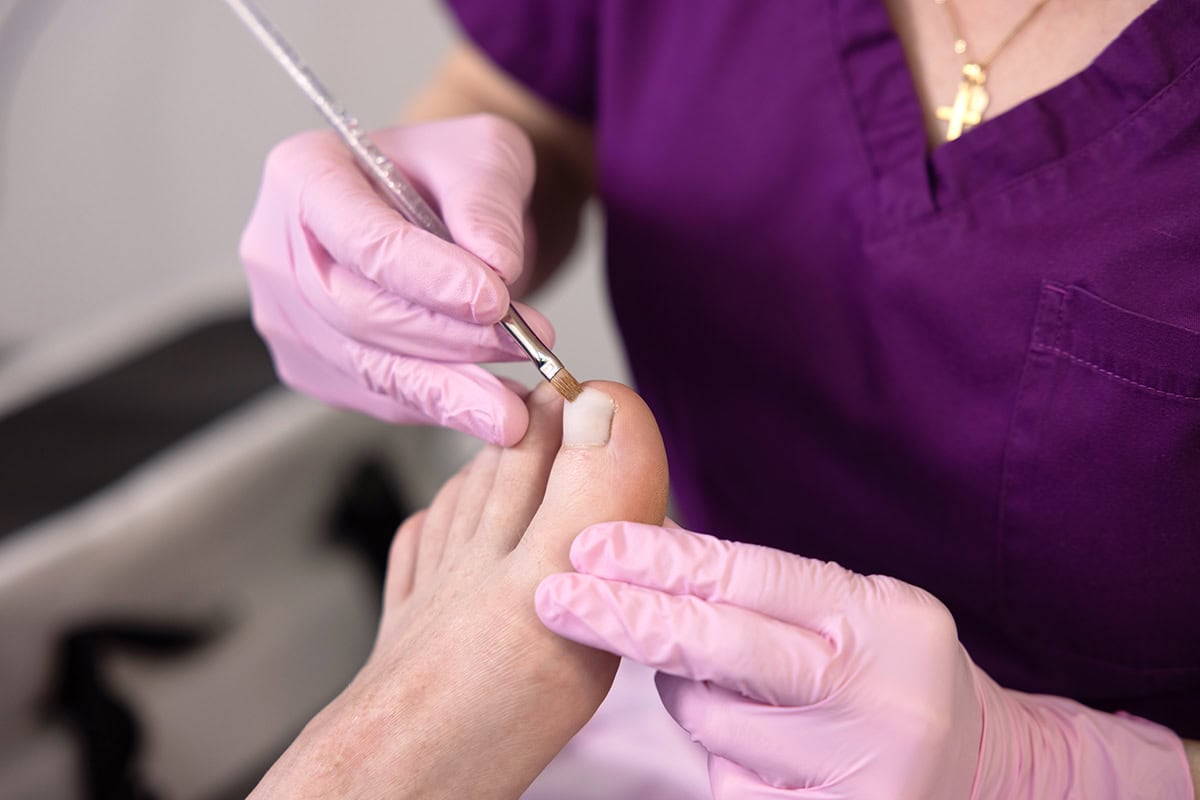 podologie judith straessle nagelprothetik2