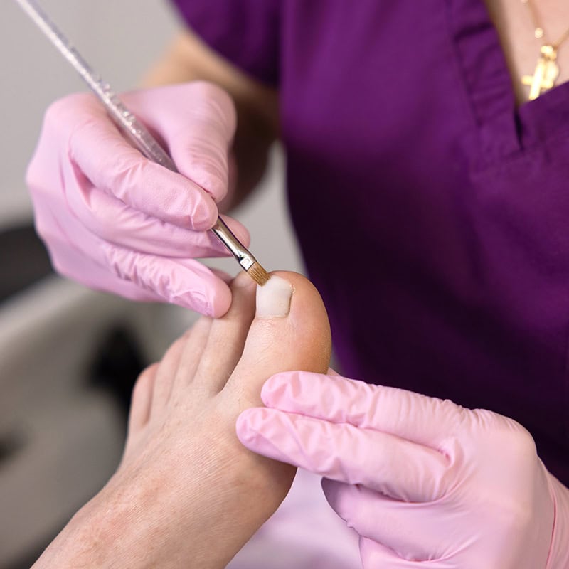 podologie judith straessle nagelprothetik3